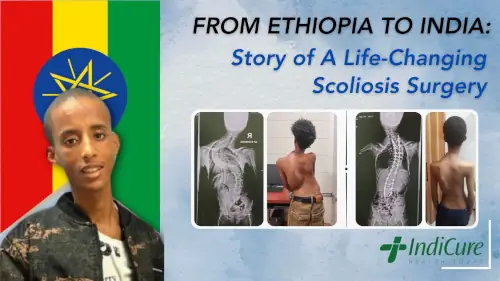 Blog cover image featuring Aron from Ethiopia and his scoliosis X-rays, showcasing his journey to India for a life-changing scoliosis surgery.